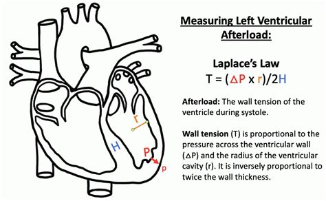 lv ot|severe lvoto surgery.